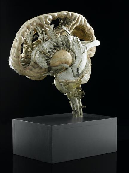 Main section of model human brain