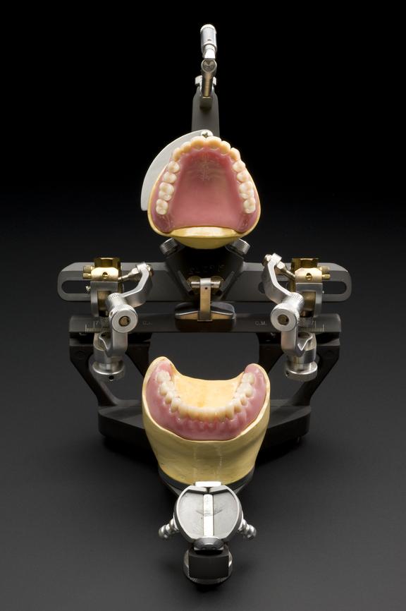 Full, upper and lower dentures, acrylic, on plaster casts