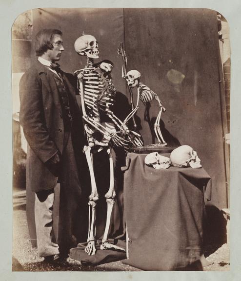 Reginald Southey with Skeletons