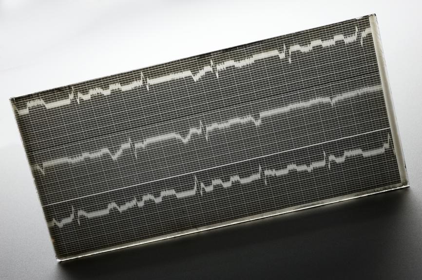 Glass negative of ECG trace