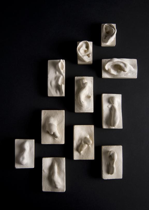 Collection of 13 plaster casts of diseased ENT organs