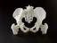 3D printed pelvis scaffold