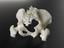 3D printed pelvis scaffold