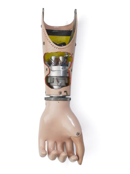 Prosthetic Hand Powered by Carbon Dioxide | Science Museum Group Collection