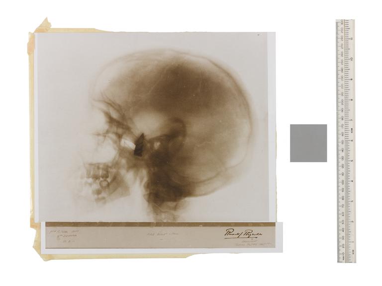 Framed photographic print of x-ray taken by Russell Reynolds