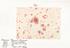 Collection of 15 watercolour illustrations of pox lesions in human skin