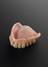 Acrylic upper denture reinforced with orientated polythene