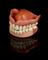 Full upper and lower denture