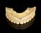 Full upper denture, crude, ivory, English, 1780-1860.