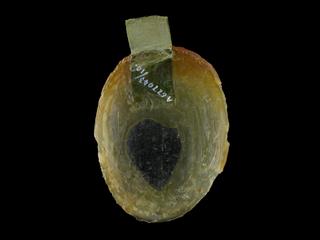 Front wall of uterus with window to show interior from wax anatomical figure of reclining woman