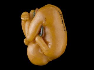 Fetus from wax anatomical figure of reclining woman