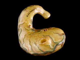 Stomach from wax anatomical figure of reclining woman