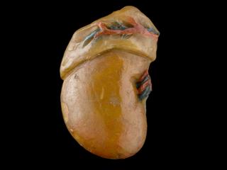Front side of right kidney showing internal structure from wax anatomical figure of reclining woman