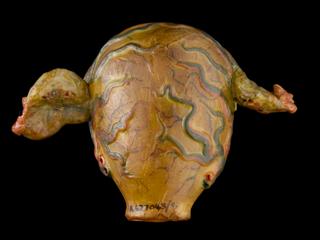 Uterus, showing placenta