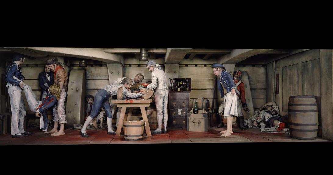 Diorama showing naval surgery in the 1800s | Science Museum Group ...