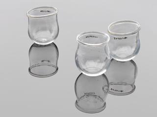 Cupping glasses used by Edward Jenner