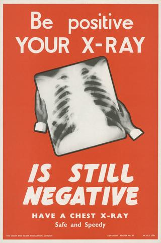 Promotional poster for mass miniature radiography