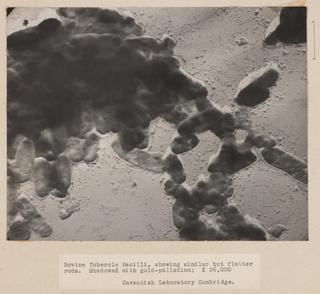 Electron micrograms of (a) Avian tubercle bacilli (b) Bovine tubercle bacilli