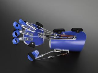 SaeboFlex, a mechanical orthotic device for people with neurological impairments