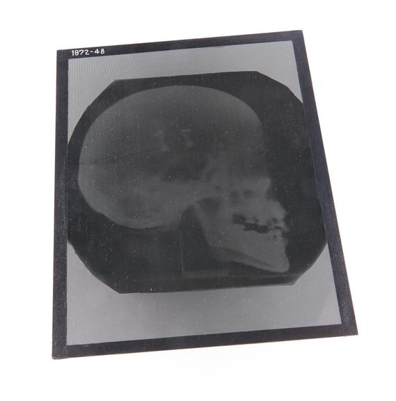 Stereoscopic radiograph of a skull (side view), 1940-1950.