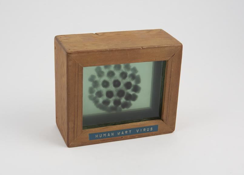 Three dimensional electron density map (glass) of human wart