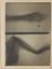 Photographic prints of early X-rays taken by E. E