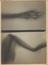 Photographic prints of early X-rays taken by E. E