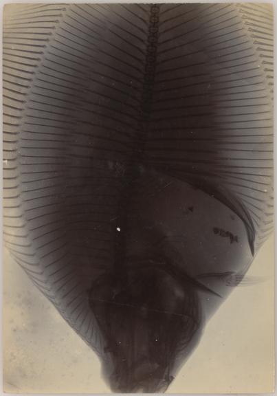 Photographic print of early x-ray