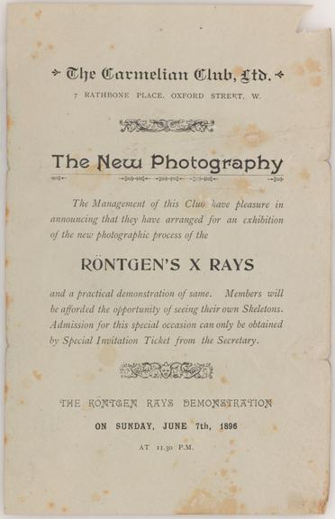 Early x-ray photographs taken by G. H. Gabb, 15 February 1896.