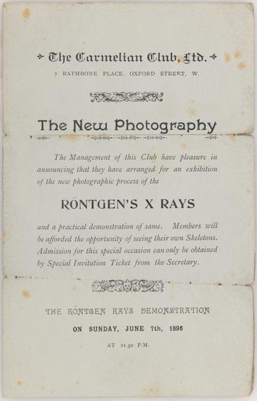 Early x-ray photographs taken by G. H. Gabb, 15 February 1896.