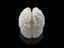 3D printed model of a healthy fetal brain at 35 weeks gestation