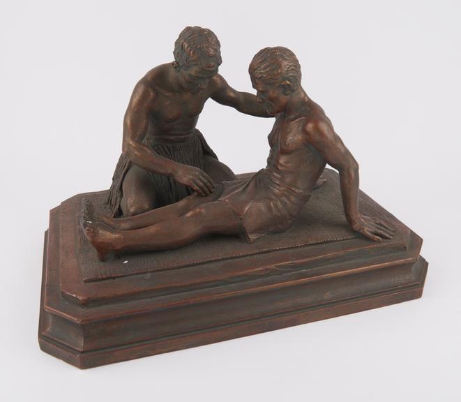 Plaster model demonstrating massage treatment called 'Te