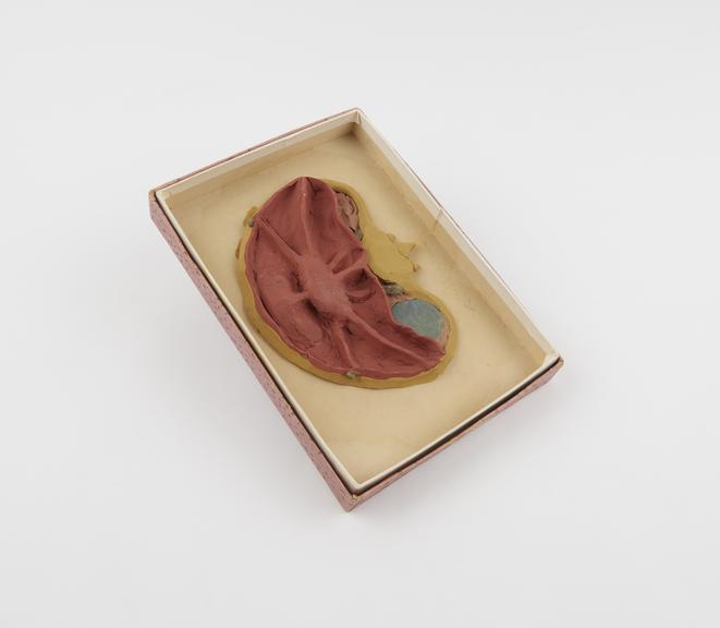 Plasticene model of human uterine supports, mounted in box