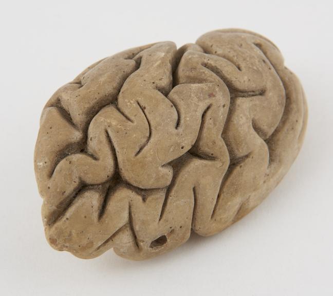 Plaster model of part of the human brain