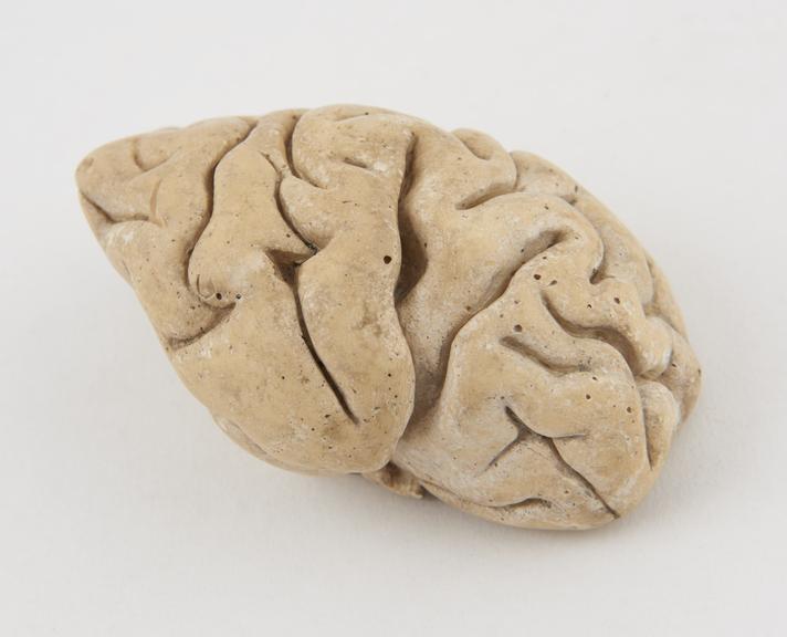 Plaster model of part of a human brain