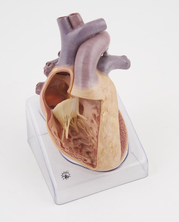 Model of the heart representing a congenital organic heart