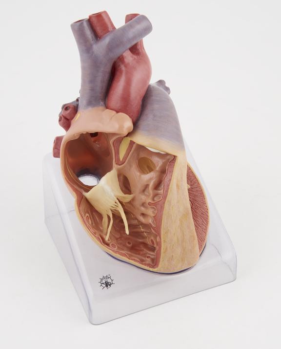 Model of the heart representing a congenital organic heart