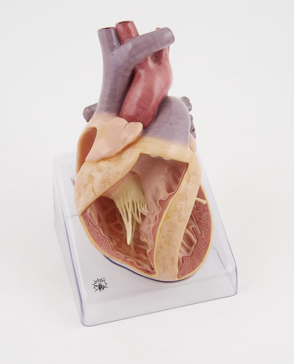 Model of the heart representing a congenital organic heart