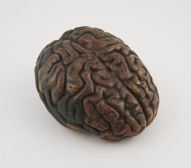 Plaster model of a brain