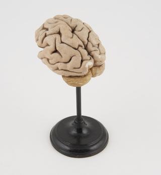 Exhibition stand for Model brain of microcephalic person