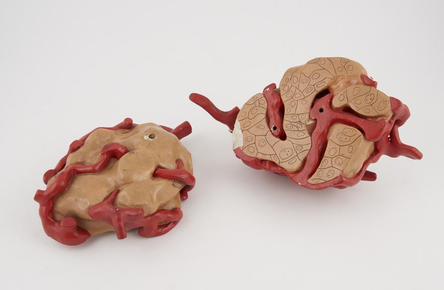 Plaster model of an unidentified human organ, sectioned