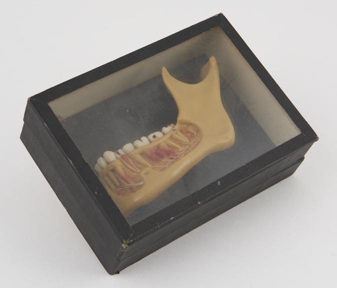 Wax copy of half a human mandible, sectioned