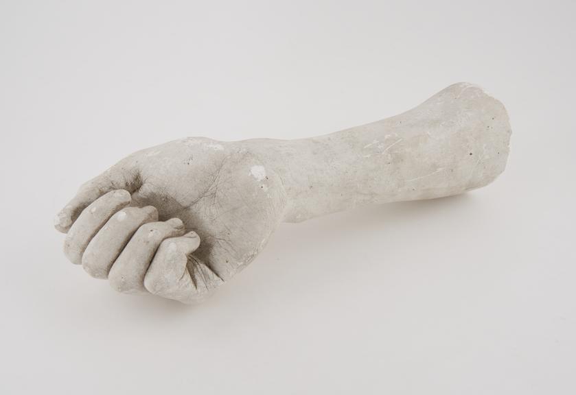 Plaster cast of right hand, white, possibly from F.S