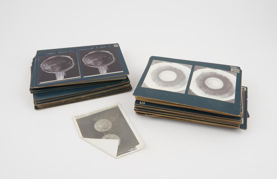 Cards of anatomical subjects and human embryo development