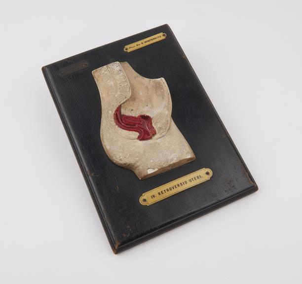 Mounted anatomical plaque showing the uterus, marked 'Prof. Dr