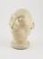 Phrenological cast of microcephalic head, defaced