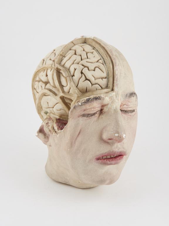 Anatomical cast or model of human head with left hand side