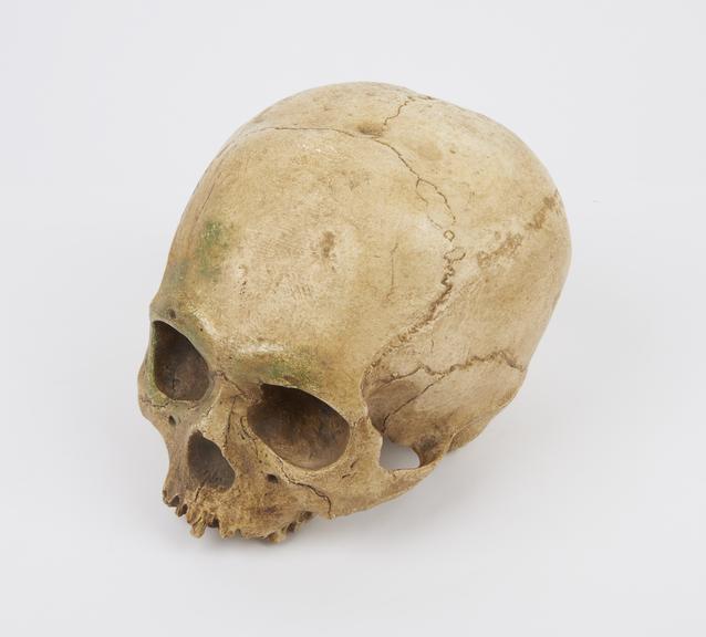 Plaster cast of human skull, no mandible