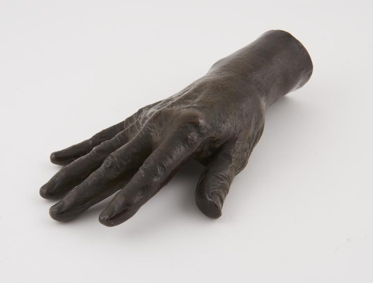 Bronze cast of a right hand, belonging to Dr William W