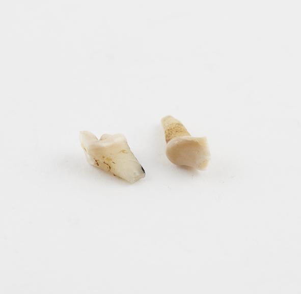 Tooth of female wolf, to cure pain in temples, for young girls